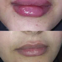 جشنواره ژل و تمامی خدمات پوست و مو