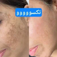 پوست کره ای