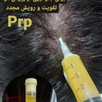 انواع خدمات ژل بوتاکس انزیم تخفیف ویژه|خدمات آرایشگری و زیبایی|کوهدشت, |دیوار