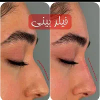 جشنواره کلینیک زیبایی / بوتاکس فیلر مزو ژل لب روسی|خدمات آرایشگری و زیبایی|مشهد, هنرستان|دیوار