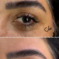 اصلاح صورت و قرینه سازی ابرو