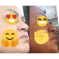 کرم ثابت شده/ضدلک/روشن‌کننده عجیب/ضمانت بازگشت وجه