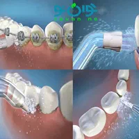 واترجت دندان شارژی ارتودنسی کامپوزیت ایمپلنت|آرایشی، بهداشتی، درمانی|تبریز, |دیوار