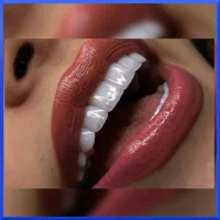 جشنواره یلدادندانپزشکی ایمپلنت لمینت کامپوزیت