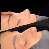 عمل جراحی بینی 24 لیفت صورت پیکرتراشی