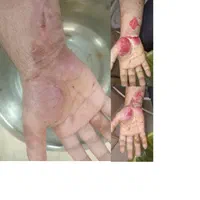 کلینیک زخم نور|خدمات آرایشگری و زیبایی|خرم‌آباد, |دیوار