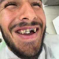 دندانپزشکی ایمپلنت+لمینت+کامپوزیت+ارتودنسی اقساط|خدمات آرایشگری و زیبایی|مشهد, سجاد شهر|دیوار