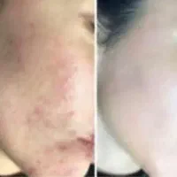 کرم دستیاز سوپر وی آی پی