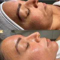 فیشیال تخصصی و کلاسیک فقطط هزینه ی مواد
