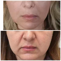 تخفیفات به مناسبت افتتاحیه