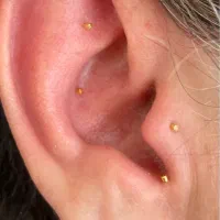 درمان تضمینی بیماری ها با طب سوزنی گوش ای اس پی|خدمات آرایشگری و زیبایی|کرمان, |دیوار