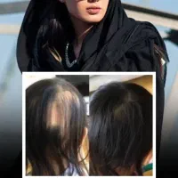 درمان پوست و مو