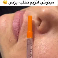 ژل و بوتاکس فقط سی سی 350|خدمات آرایشگری و زیبایی|تهران, مختاری|دیوار
