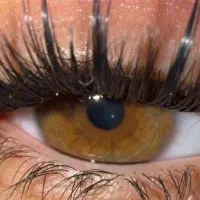 اکستیشن مژه