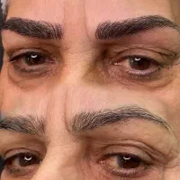 یک مدل فیبروز