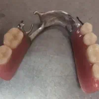 لابراتوار دندانسازی تخصصی (ساخت دندان مصنوعی)|آرایشی، بهداشتی، درمانی|اصفهان, کشاورزی|دیوار