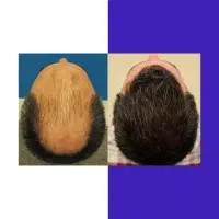 هزینه کمتر رویش بهتر