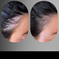پاکسازی پوست ، ژل و بوتاکس در کلینیک زیبایی|خدمات آرایشگری و زیبایی|اهواز, پادادشهر|دیوار