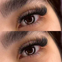 کاشت مژه هیدن فقط ۲۵۰