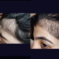 اتو|اتو و لوازم اتو|بندرعباس, |دیوار