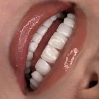 نیاز به یه نفر نیرو خانم  دستیار  دندانپزشکی