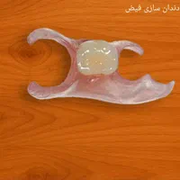 دندان‌سازی. دندان‌مصنوعی. لابراتوار دندانسازی|خدمات آرایشگری و زیبایی|مشهد, ولیعصر (شهرک غرب)|دیوار