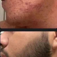 اگه ریشه داری و ریش نداری بیا پیش خودم