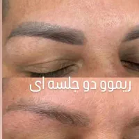 ریموو درمانی تتو های بدرنگ قدیمی|خدمات آرایشگری و زیبایی|الشتر, |دیوار