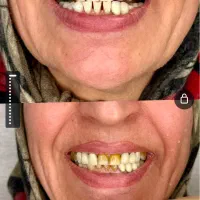 دندانپزشکی و ایمپلنت/تعرفه دولتی/بیمه/اقساط