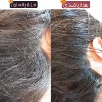 درمان رشک و شپش زیر نظر استاد حرفه ای