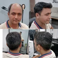 پروتز مو و خدمات تعویض چسب اورجینال سوپر تیپ