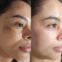 پاکسازی و فیشیالvipبا مواد اکلادو ۳۰۰ اندیشه ۷۱