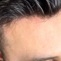 انواع پروتز مو فقط اورجینال وارداتی(نقد و اقساط)|آرایشی، بهداشتی، درمانی|تهران, فردوس|دیوار