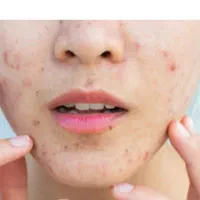 راهنمایی برای سلامتی پوست