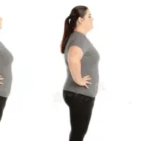 لاغری با دستگاه های غیر تهاجمی بدون عوارض