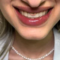 زیبایی|خدمات زیبایی و سلامت|آمل, |دیوار