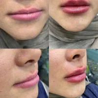 پزشک عمومی کلینیک زیبایی مسئول فنی پروانه اندیشه|استخدام درمانی، زیبایی، بهداشتی|اندیشه, اندیشه فاز ۱|دیوار