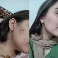 فروش دم نوش هاو روغن های گیاهی دارای‌مجوز بهداشت|آرایشی، بهداشتی، درمانی|سنندج, |دیوار