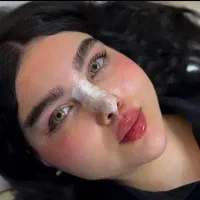 خدمات تخصصی ژل بوتاکس فیلر توسط پزشک