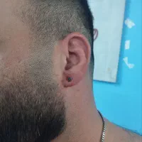 اصلاح خالبرداری لیزری پرسینگ گوش پاکسازی کامل پوست