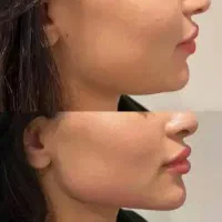 جشنواره مطب زیبایی ماهورا|خدمات آرایشگری و زیبایی|قروه, |دیوار