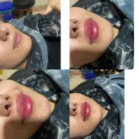 ژل بوتاکس|خدمات آرایشگری و زیبایی|دورود, |دیوار