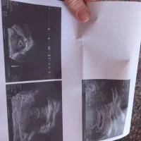 تایپیست سونوگرافی