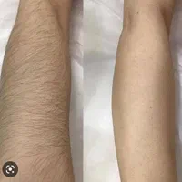 20%تخفیف خدمات پوستی،co2فرکشنال،ریموو تتو،کیوسویج|خدمات آرایشگری و زیبایی|سیرجان, |دیوار