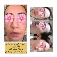 فرمول سفید کننده قوی پوست|آرایشی، بهداشتی، درمانی|ایرانشهر, |دیوار