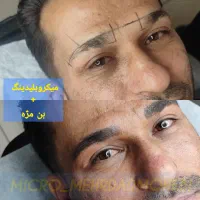 میکروبلیدینگ ابرو/رفع تیرگی لب/اسکالپ سر|خدمات آرایشگری و زیبایی|تهران, نیاوران|دیوار