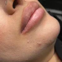 شیدلب|خدمات زیبایی و سلامت|دورود, |دیوار