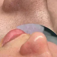 پاکسازی صورت