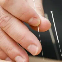 طب سوزنی-طب سنتی