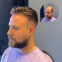 پروتز مو معجزه زیبایی|خدمات آرایشگری و زیبایی|اصفهان, ملک|دیوار